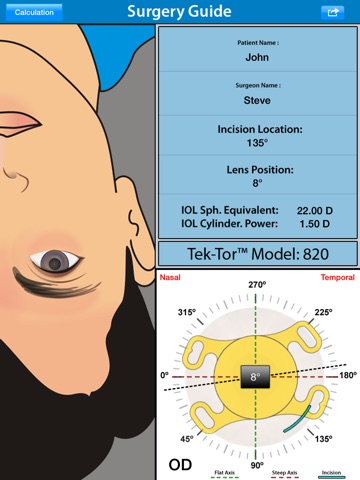 Tek-Tor™ Toric Calculator by TEKIA, Inc. screenshot 3