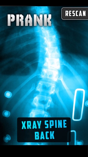 Simulator X-Ray Spine Back(圖2)-速報App