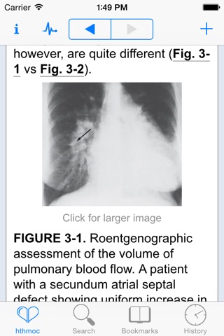 Hurst's the Heart Manual of Cardiology, Thirteenth Edition screenshot 3