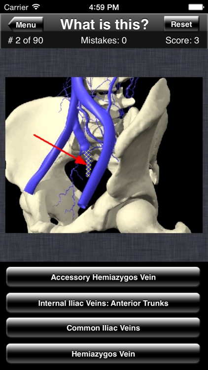 Anatomy Spine Quiz screenshot-4
