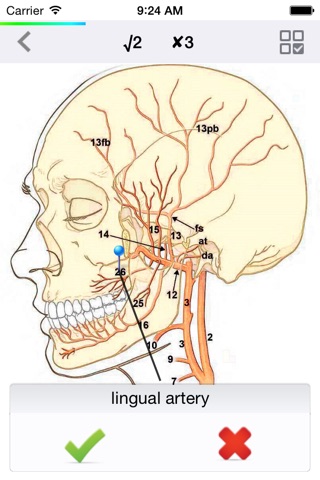 Isaiah cerebral vascular Atlas screenshot 4