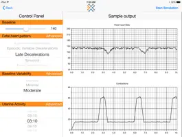 Game screenshot Simulated Electronic Fetal Monitor apk