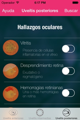 Uveitis doctor screenshot 2