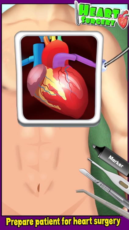Heart Surgery Doctor Simulator!