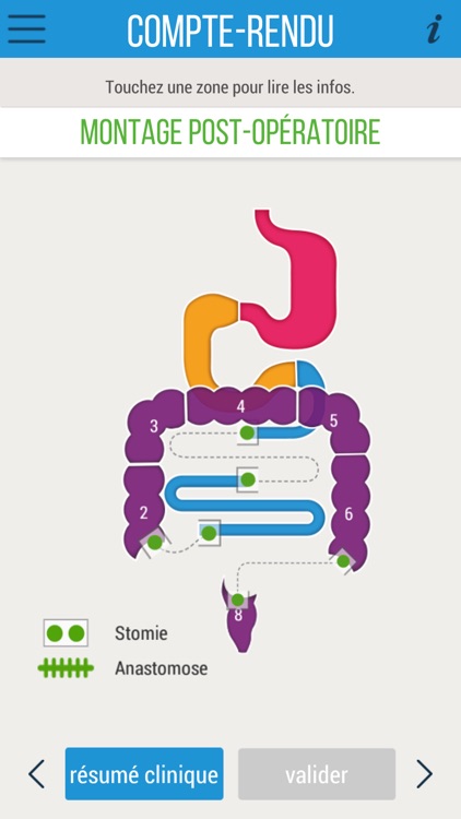 iRESECTIONintestinale screenshot-3