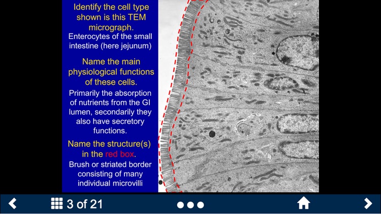 Histology – Gastrointestinal Tract screenshot-3