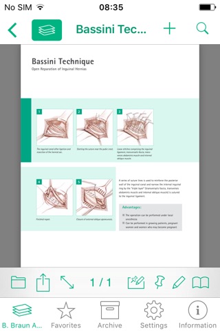 B. Braun Abdominal Wall Health screenshot 4