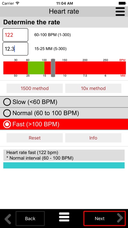 ECG Calc Lite