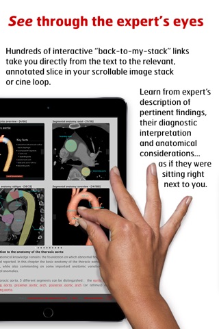 Radiology - Aortic Imaging screenshot 4