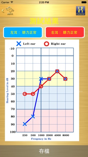 MFA Hearing Test(圖5)-速報App