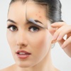Acne 101-How to Get Rid of Pimples