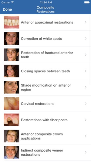 Dental Composite(圖1)-速報App