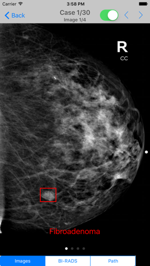 Mammogram Atlas(圖4)-速報App