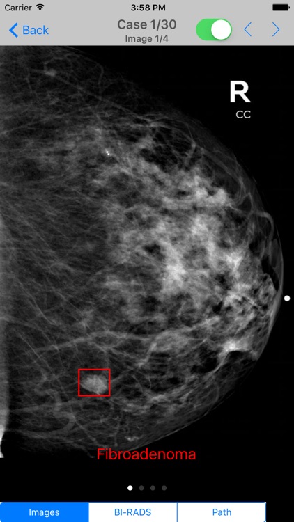 Mammogram Atlas screenshot-3