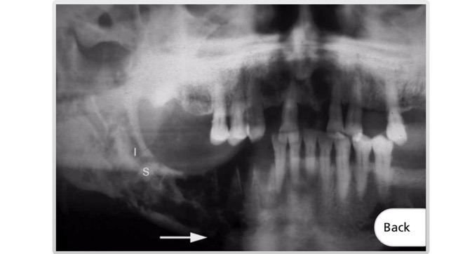 Maxillofacial Pathology(圖5)-速報App