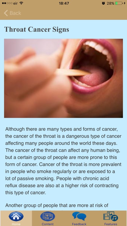 Symptoms Of Throat Cancer
