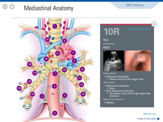 AABIP Clinician’s Guide to EBUS for iPad(圖3)-速報App