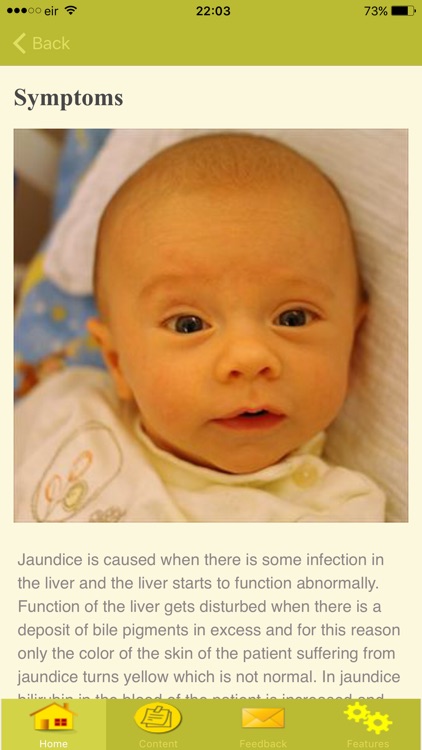 Symptoms Of Jaundice