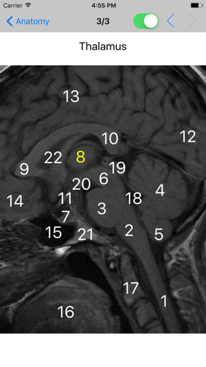 Brain Images(圖2)-速報App