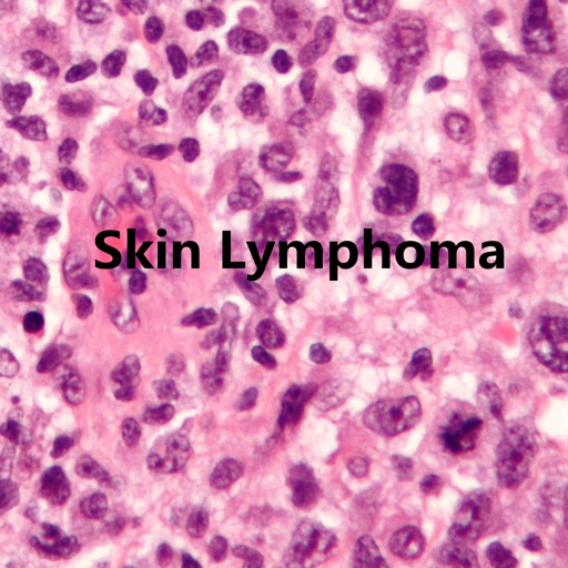 Skin Lymphoma Treatment-The Illustrated Guide icon