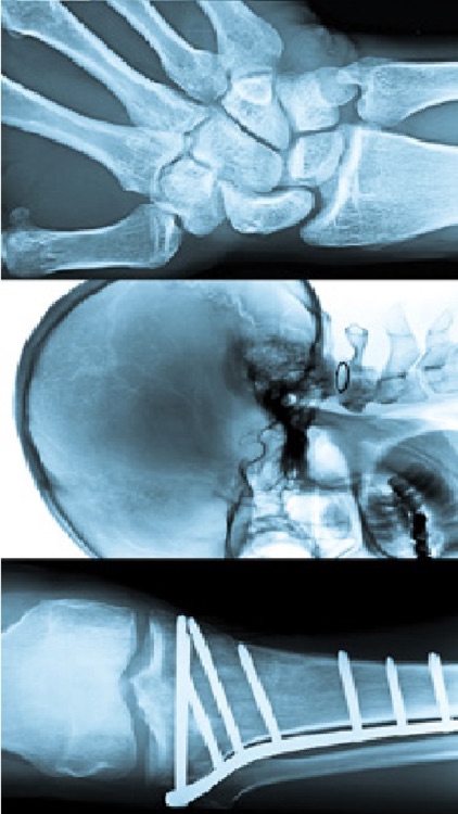 RSM Trauma