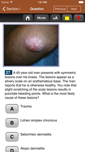 USMLE Images for the Boards(圖5)-速報App