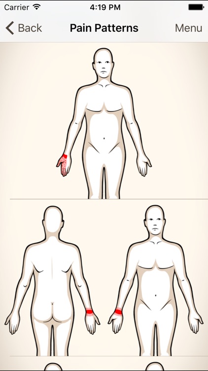 Clinical Pattern Recognition: Wrist and Hand Pain