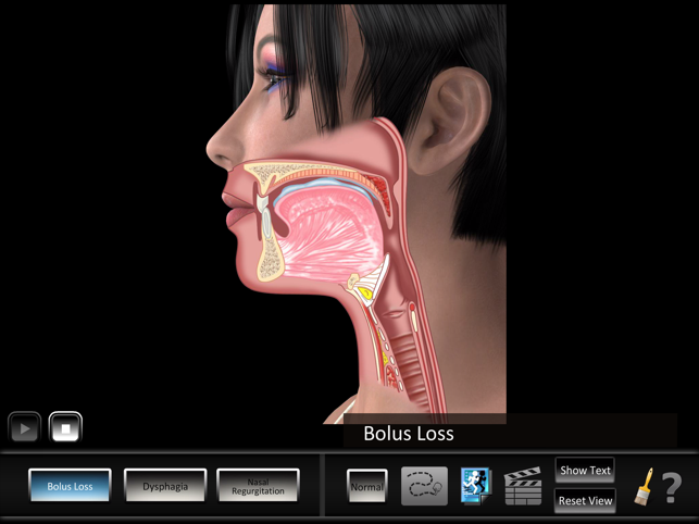 Oral Disorders