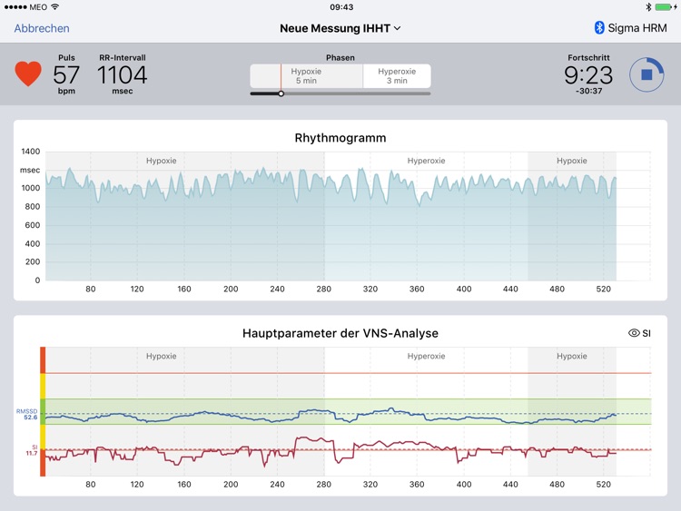 VNS Analyse RT