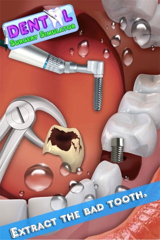 Dental Surgery Simulator screenshot 4