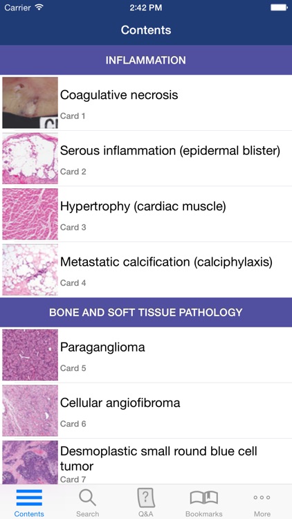 McGraw-Hill Specialty Board Review Anatomic Pathology Flashcards