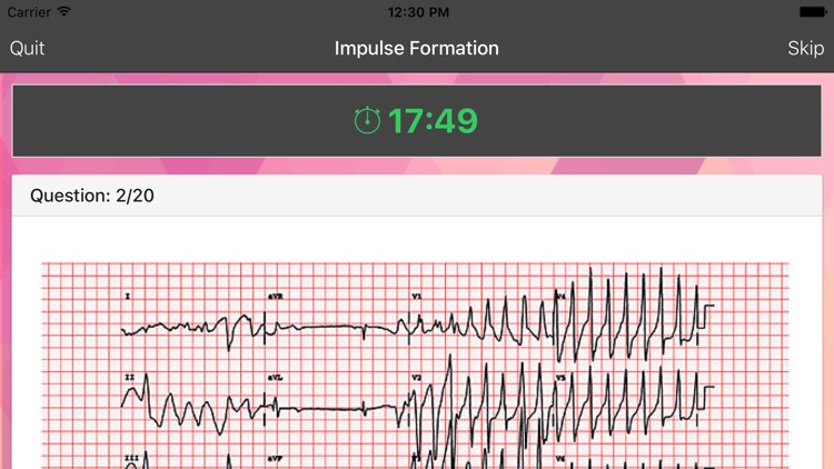 ECG Master - Quiz, Exam, Explanation, Statistic