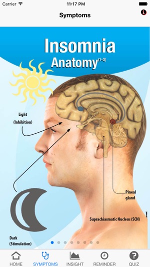 Signs & Symptoms Insomnia(圖2)-速報App