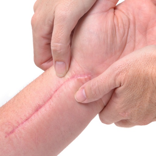 How to Rehabilitate Traumatic Scars-Tips icon