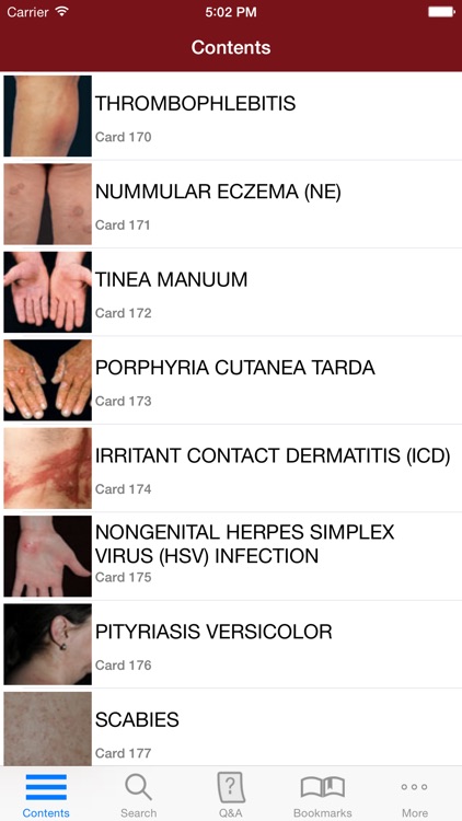 Fitzpatrick's Dermatology Flash Cards