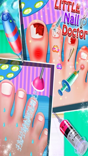 Toe Nail Doctor - Little Nail Surgery kids games(圖2)-速報App