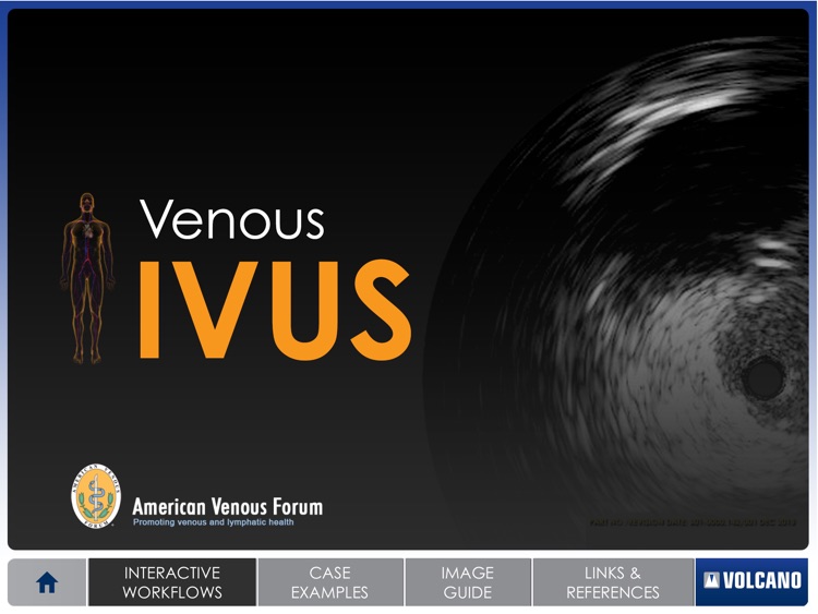 Venous IVUS