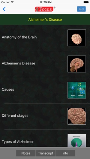 Neurology - Understanding Disease(圖3)-速報App