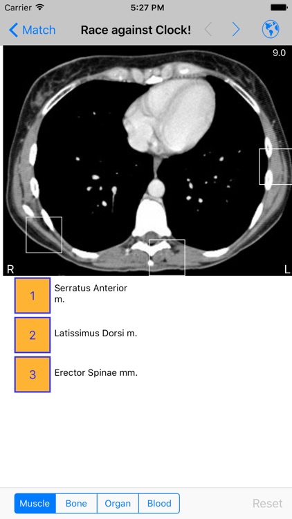 iAnatomy screenshot-4