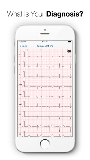 ECG Quiz Pro(圖3)-速報App