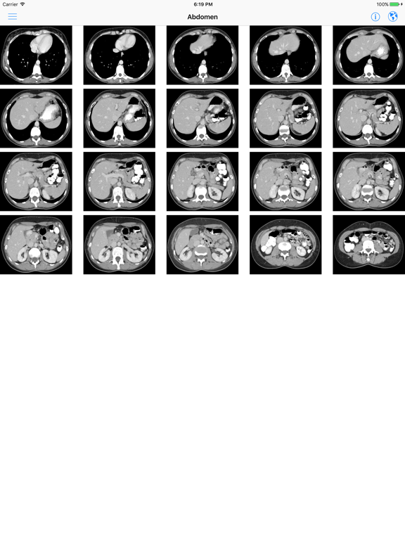 Screenshot #5 pour iAnatomy