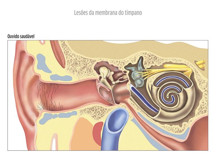 ORL Atlas GSK, iPad