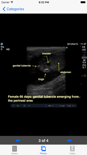 Advanced Equine Reproductive Ultrasound(圖5)-速報App