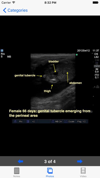 Advanced Equine Reproductive Ultrasound screenshot-4