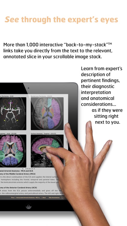 Diagnostic Radiology - Imaging in Stroke screenshot-3