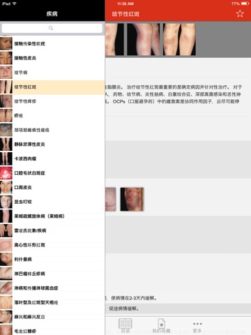 Derm101 Point of Care: 皮肤诊疗助手 screenshot 2