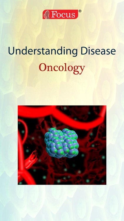 Oncology - Understanding Disease