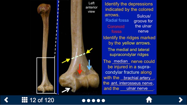 MSK Anatomy - SecondLook(圖4)-速報App