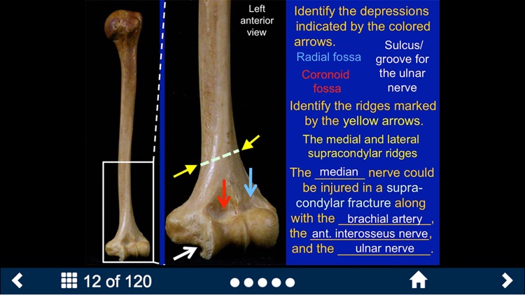 MSK Anatomy - SecondLook screenshot-3
