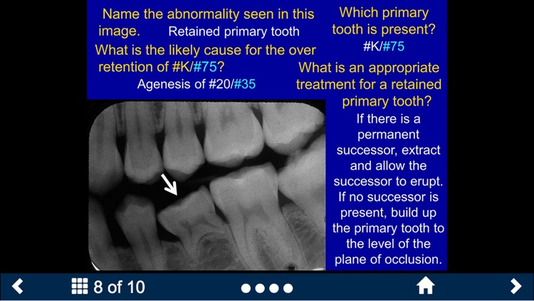 Oral Radiology Lite - SecondLook screenshot-3